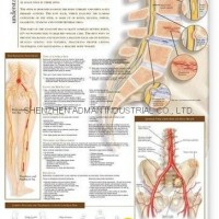 low back pain--3D RELIEF WALL MEDICAL/PHARMA CHART/POSTER