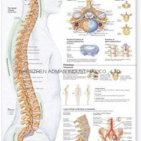 human spine disorders--3D RELIEF WALL MEDICAL/PHARMA CHART/POSTER