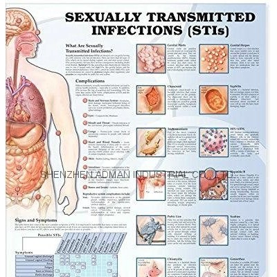 SEXUALLY TRANSMITTED INFECTIONS(STIs--3D RELIEF WALL MEDICAL/PHARMA CHART/POSTERpicture1