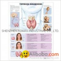 THYROID DISORDERS--3D RELIEF WALL MEDICAL/PHARMA CHART/POSTER