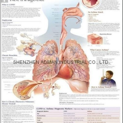 DOPD & ASTHMA--3D RELIEF WALL MEDICAL/PHARMA CHART/POSTERpicture1