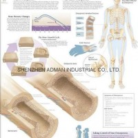 UNDERSTANDING THE PROSTATE--3D RELIEF WALL MEDICAL/PHARMA CHART/POSTER