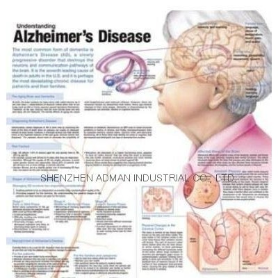 ALZHEIMER'S DISEASE--3D RELIEF WALL MEDICAL/PHARMA CHART/POSTERpicture1