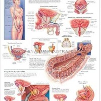 THE PROSTATE--3D RELIEF WALL MEDICAL/PHARMA CHART/POSTER